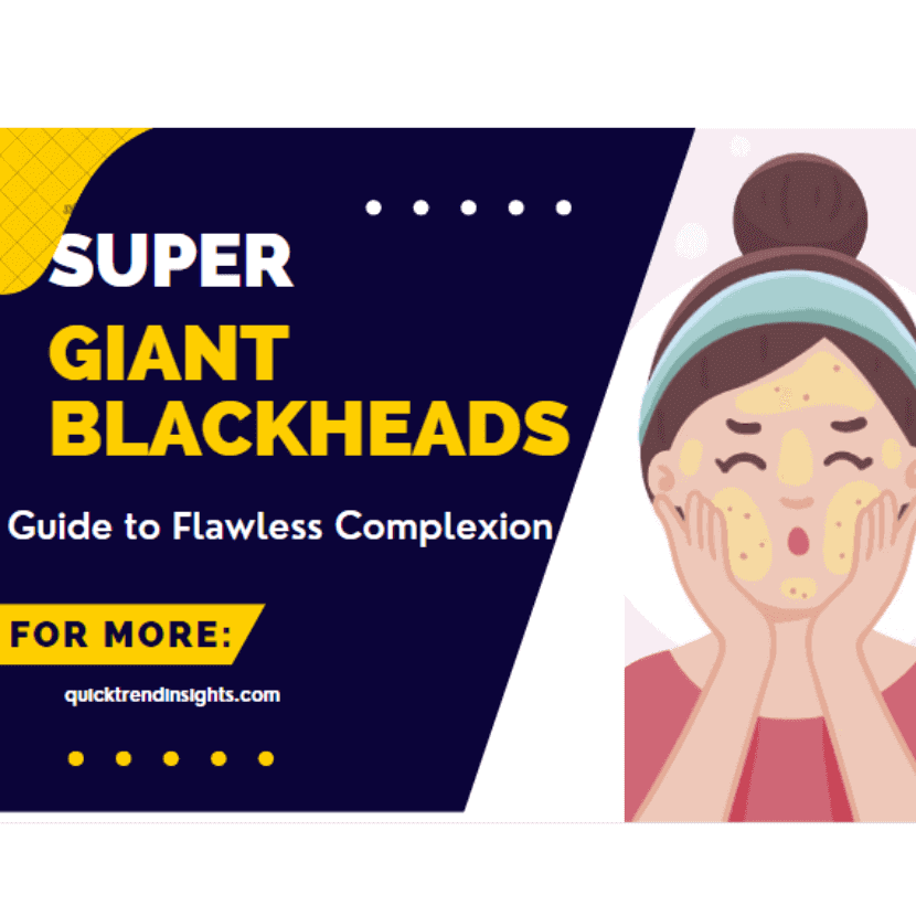 Super giant blackheads