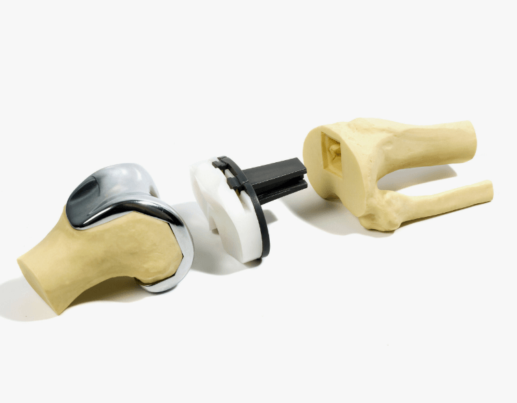 Mistakes After Knee Replacement